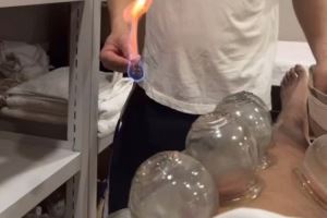 嘗試東方神秘力量！北京男籃外援斯佩爾曼曬拔火罐視頻